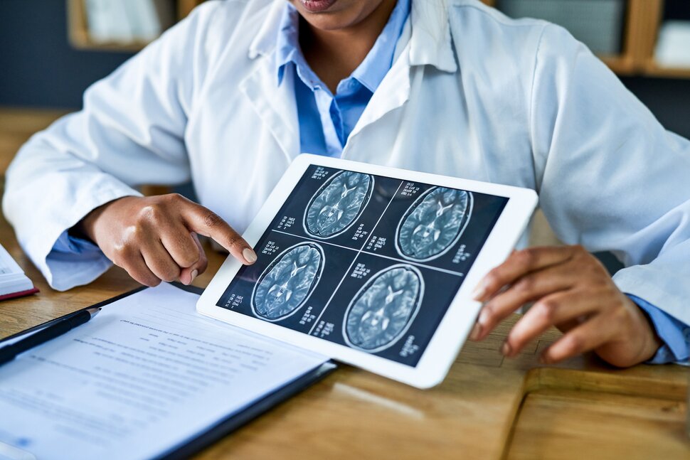 Should You See A Neurologist After A Car Accident Alabama Law Blog